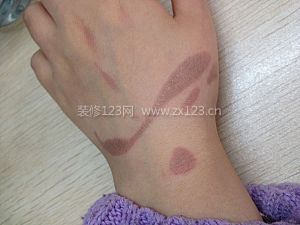 被油燙傷